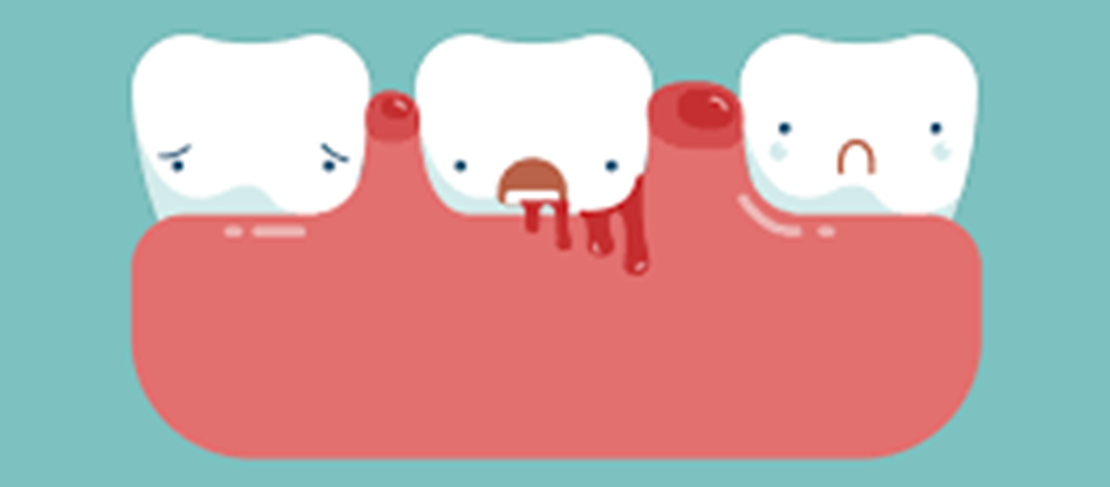 Dentures
